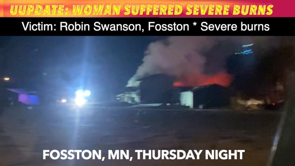 EXCLUSIVE VIDEO UPDATE Woman Suffers Severe Burns In Fosston Fire iNewZ