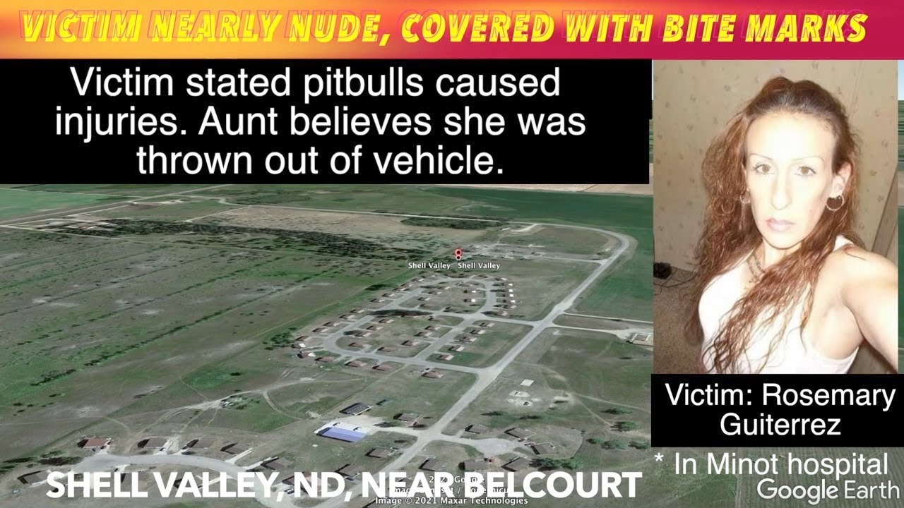 UPDATE Victim Of Vicious Attack Reveals New Information iNewZ