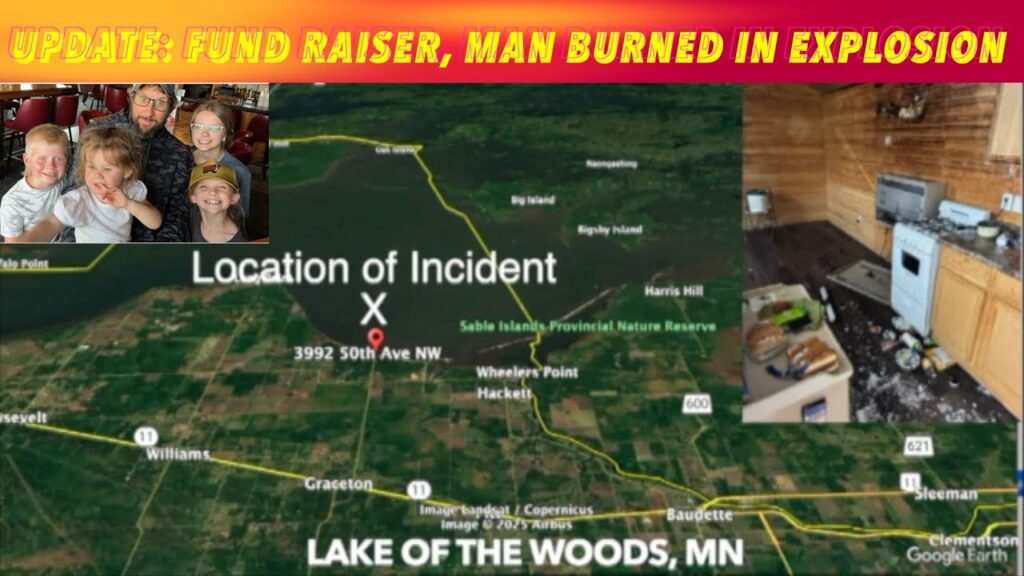UPDATE: Fund Raiser For Man Burned In Explosion On Lake Of The Woods ...